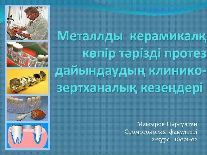 Металлды керамикалқ көпір тәрізді протез дайындаудың клиникозертханалық кезеңдері. Мамыров Нұрсұлтан Стомотология факултеті 2 -курс