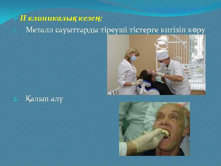 Ø II клиникалық кезең: 1. Металл сауыттарды тіреуші тістерге кигізіп көру 2. Қалып алу