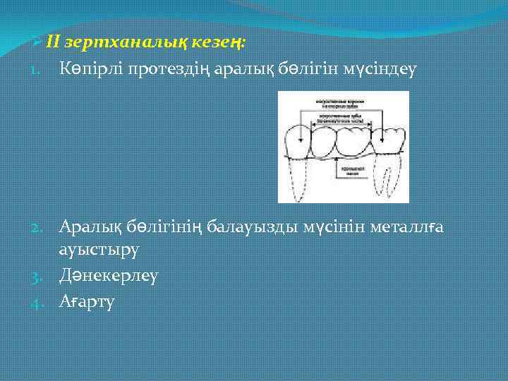 Ø II зертханалық кезең: 1. Көпірлі протездің аралық бөлігін мүсіндеу 2. Аралық бөлігінің балауызды