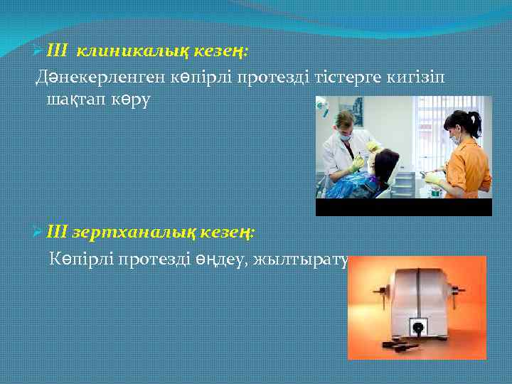 Ø III клиникалық кезең: Дәнекерленген көпірлі протезді тістерге кигізіп шақтап көру Ø III зертханалық