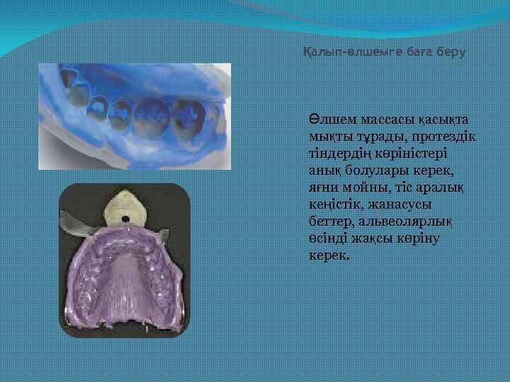 Қалып-өлшемге баға беру Өлшем массасы қасықта мықты тұрады, протездік тіндердің көріністері анық болулары керек,