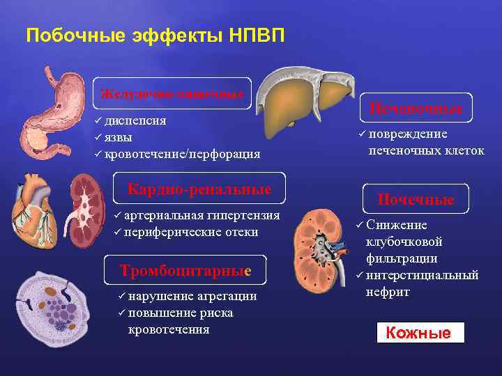 Побочные эффекты НПВП Желудочно-кишечные ü диспепсия ü язвы ü кровотечение/перфорация Кардио-ренальные ü артериальная гипертензия