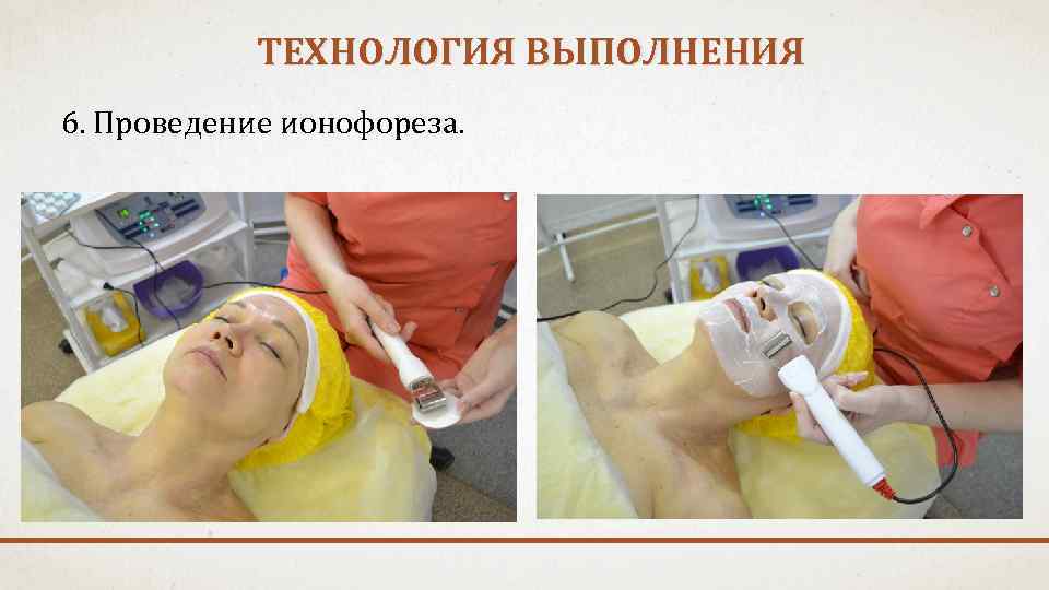 ТЕХНОЛОГИЯ ВЫПОЛНЕНИЯ 6. Проведение ионофореза. 