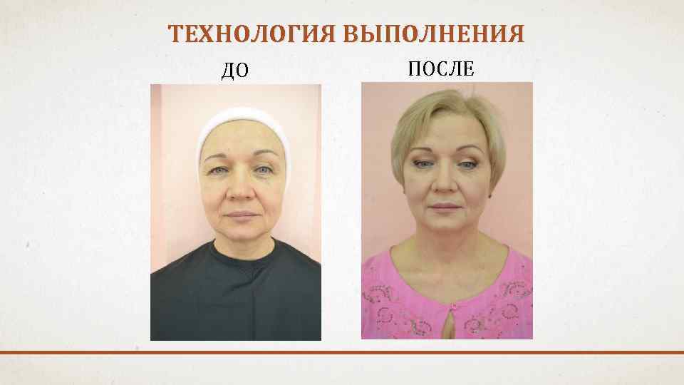 ТЕХНОЛОГИЯ ВЫПОЛНЕНИЯ ДО ПОСЛЕ 