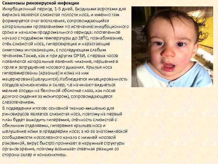Симптомы риновирусной инфекции Инкубационный период 1 -5 дней. Входными воротами для вириона является слизистая