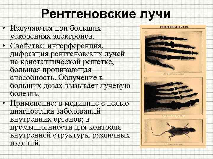 Рентгеновские лучи • Излучаются при больших ускорениях электронов. • Свойства: интерференция, дифракция рентгеновских лучей