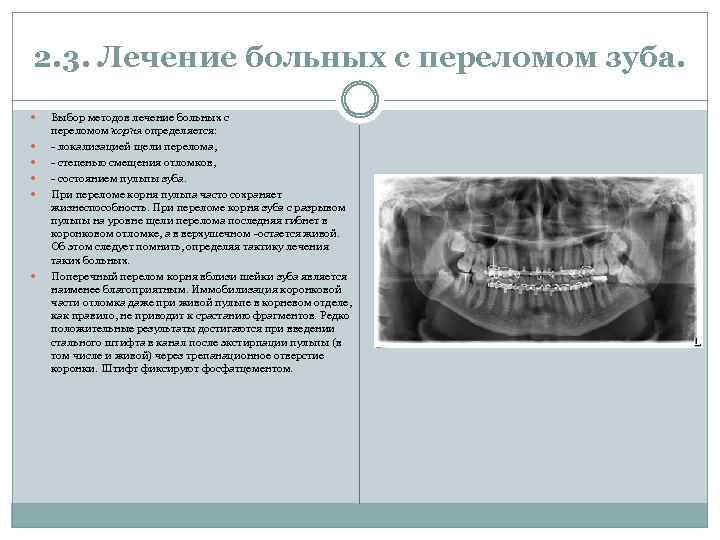 2. 3. Лечение больных с переломом зуба. Выбор методов лечение больных с переломом корня