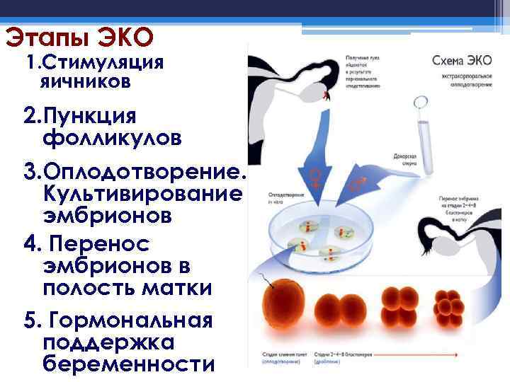 Этапы ЭКО 1. Стимуляция яичников 2. Пункция фолликулов 3. Оплодотворение. Культивирование эмбрионов 4. Перенос