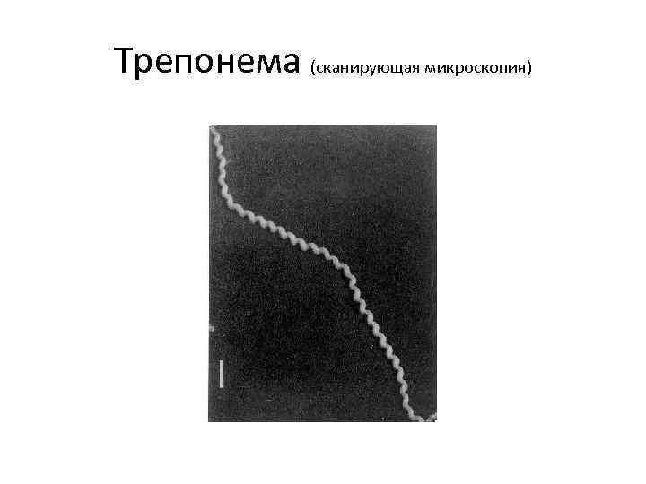 Трепонема (сканирующая микроскопия) 