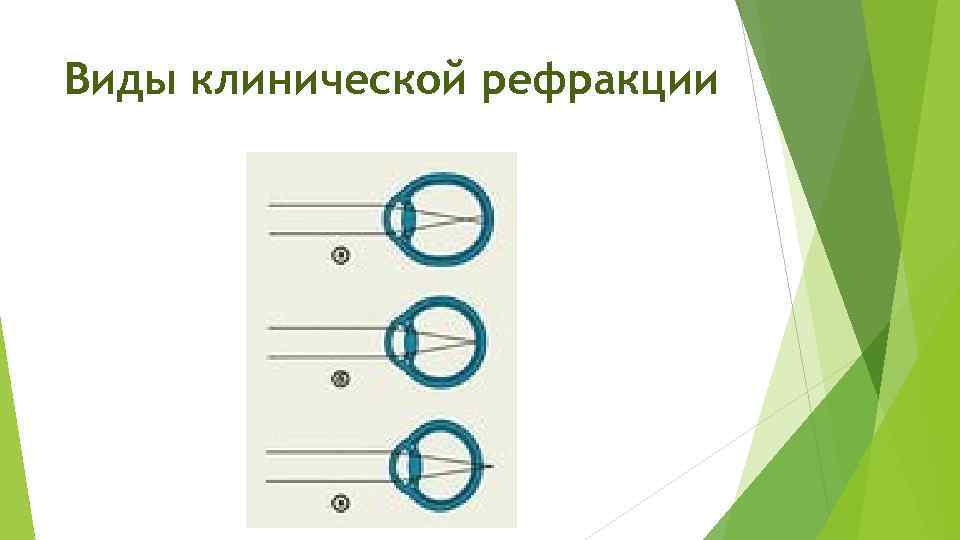 Изменение клинической рефракции глаз у школьников 10 х классов проект