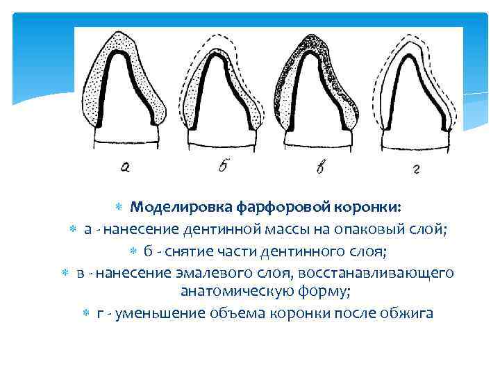  Моделировка фарфоровой коронки: а нанесение дентинной массы на опаковый слой; б снятие части