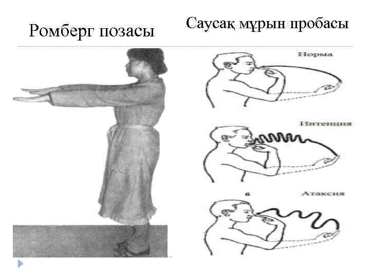 Ромберг позасы Саусақ мұрын пробасы 