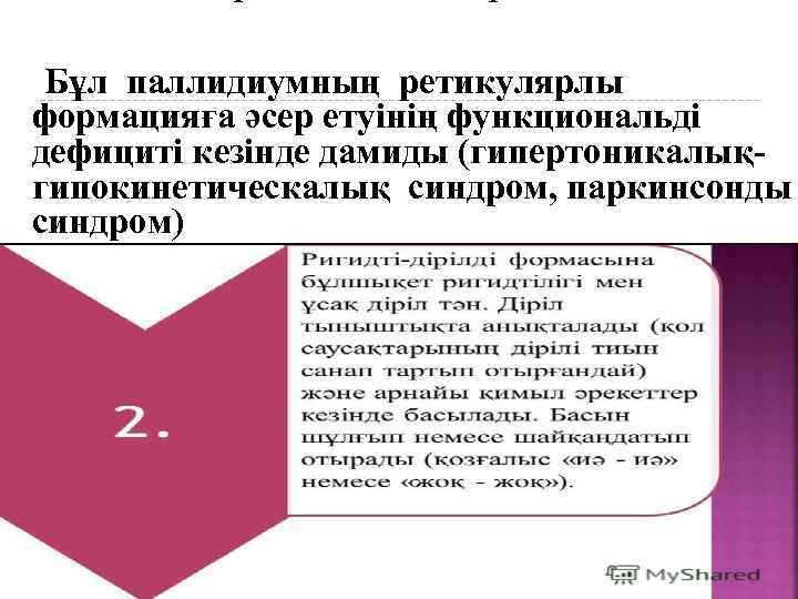  Бұл паллидиумның ретикулярлы формацияға әсер етуінің функциональді дефициті кезінде дамиды (гипертоникалықгипокинетическалық синдром, паркинсонды