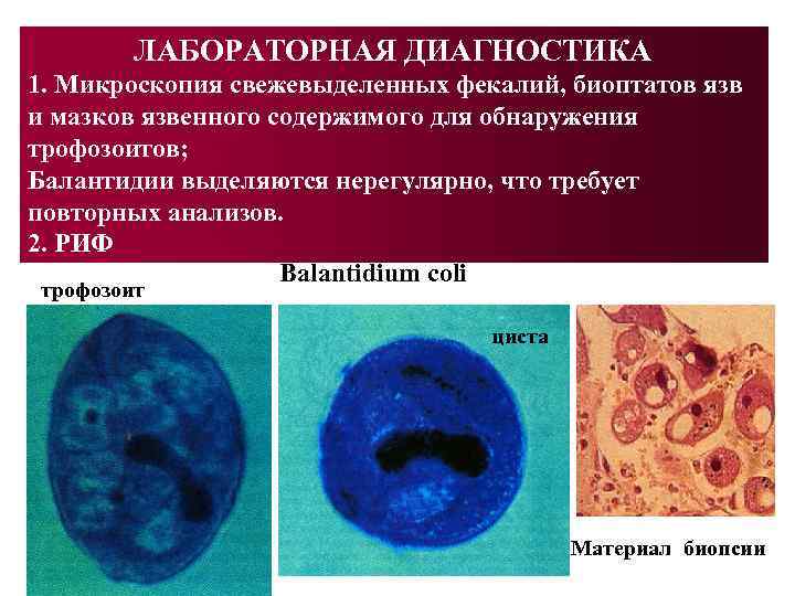  ЛАБОРАТОРНАЯ ДИАГНОСТИКА 1. Микроскопия свежевыделенных фекалий, биоптатов язв и мазков язвенного содержимого для