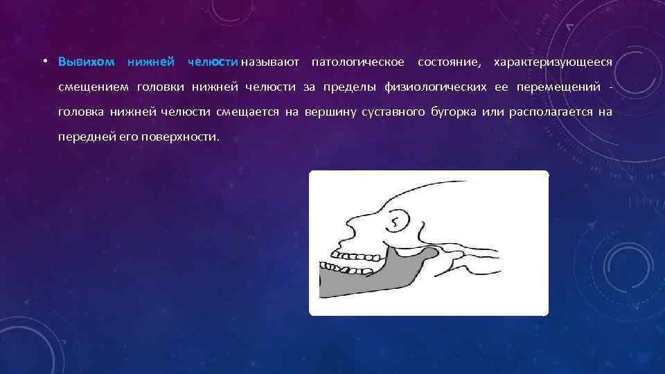 Вывих нижней челюсти презентация