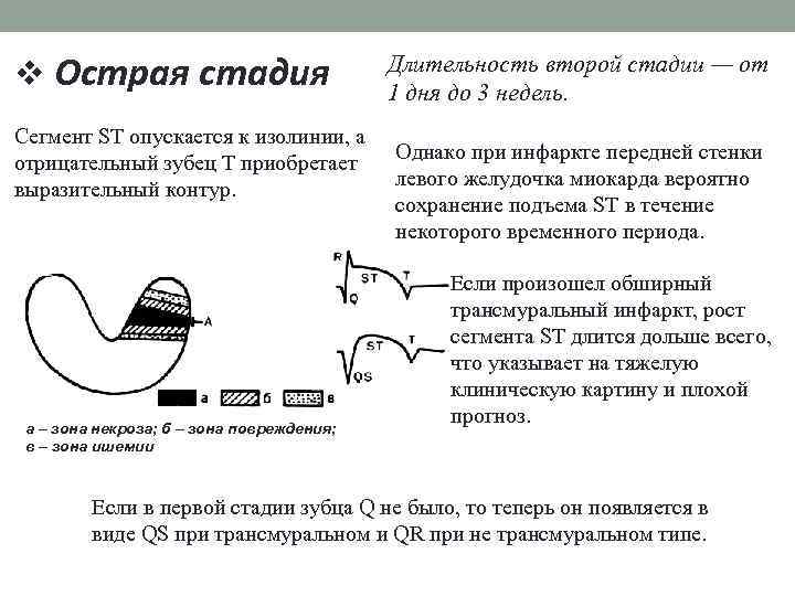 v Острая стадия Сегмент ST опускается к изолинии, а отрицательный зубец Т приобретает выразительный