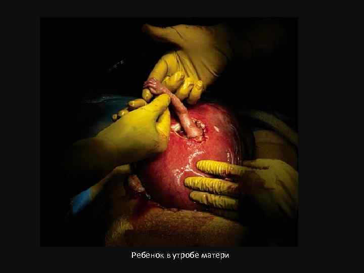 Ребенок в утробе матери 
