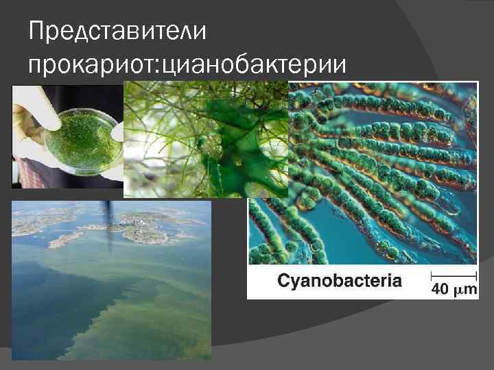 Представители прокариот: цианобактерии 