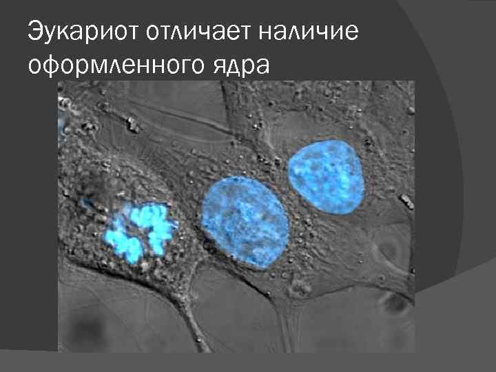 Эукариот отличает наличие оформленного ядра 