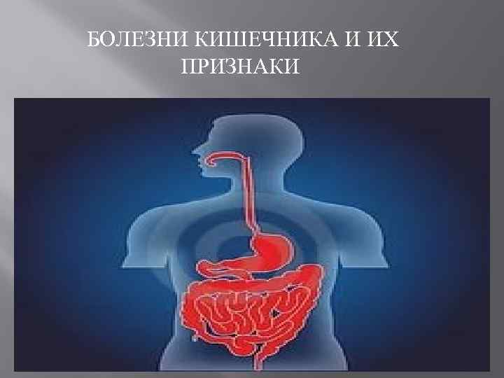 БОЛЕЗНИ КИШЕЧНИКА И ИХ ПРИЗНАКИ 