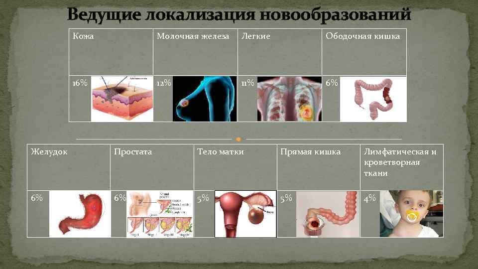 Ведущие локализация новообразований Кожа Молочная железа Легкие Ободочная кишка 16% 12% 11% 6% Желудок