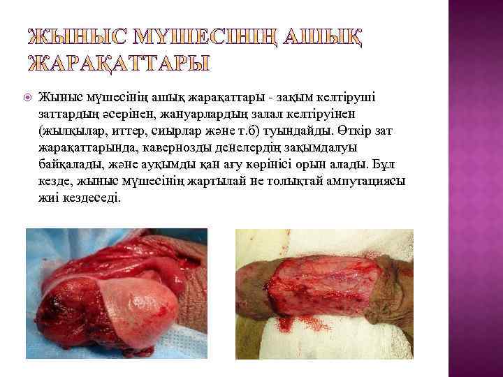 Жыныс мүшесінің ашық жарақаттары - зақым келтіруші заттардың әсерінен, жануарлардың залал келтіруінен (жылқылар,