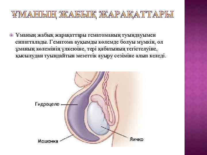  Ұманың жабық жарақаттары гематоманың туындауымен сипатталады. Гематома ауқымды көлемде болуы мүмкін, ол ұманың