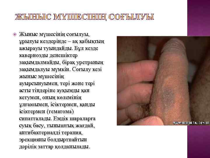  Жыныс мүшесінің соғылуы, ұрылуы кездерінде – ақ қабықтың ажырауы туындайды. Бұл кезде кавернозды