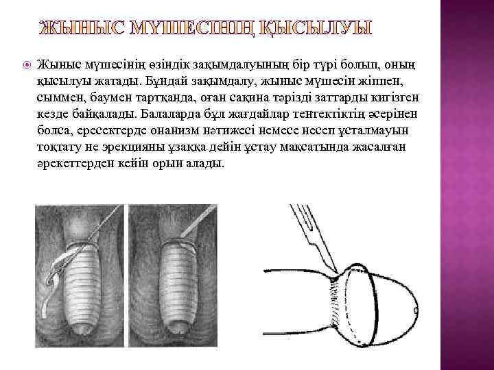  Жыныс мүшесінің өзіндік зақымдалуының бір түрі болып, оның қысылуы жатады. Бұндай зақымдалу, жыныс
