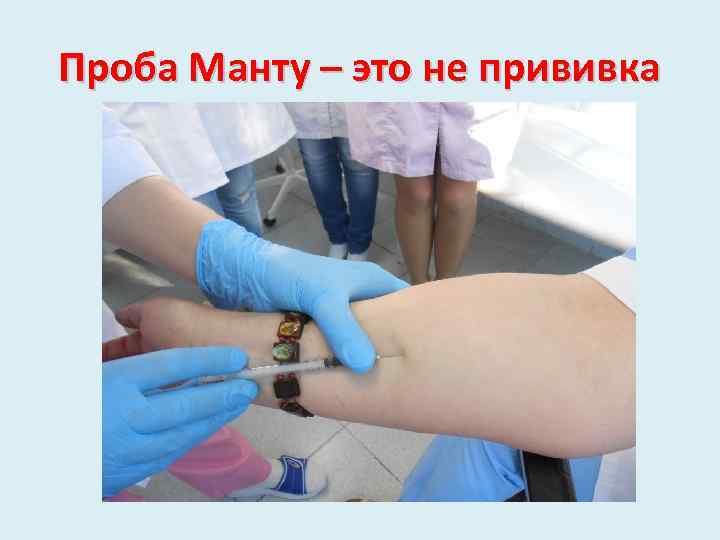 Проба Манту – это не прививка 