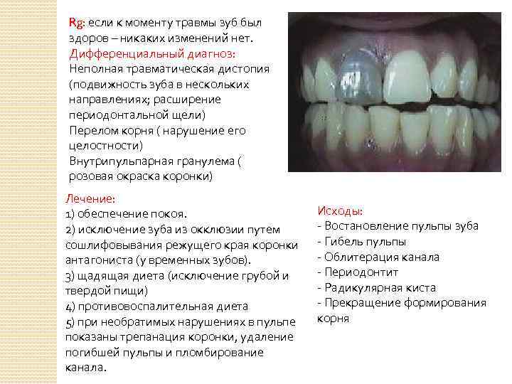 Rg: если к моменту травмы зуб был здоров – никаких изменений нет. Дифференциальный диагноз: