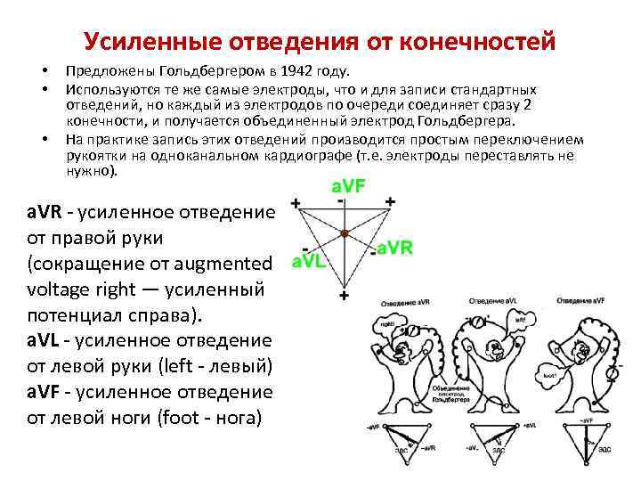 Усиленные отведения экг схема