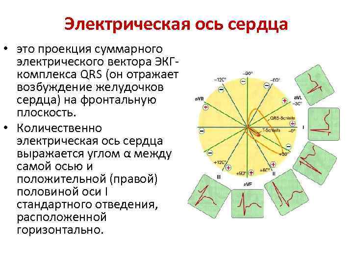 Электрическая ось сердца