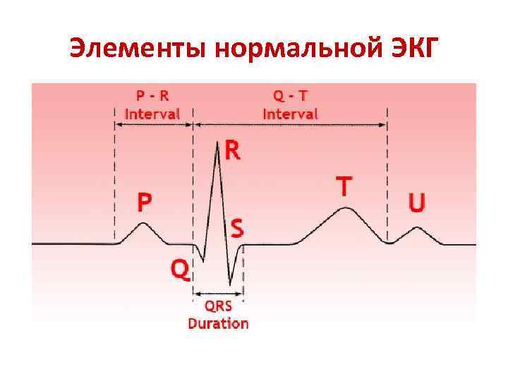 Рисунок экг с подписями