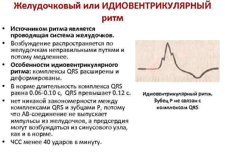 Определение источника возбуждения водителя ритма