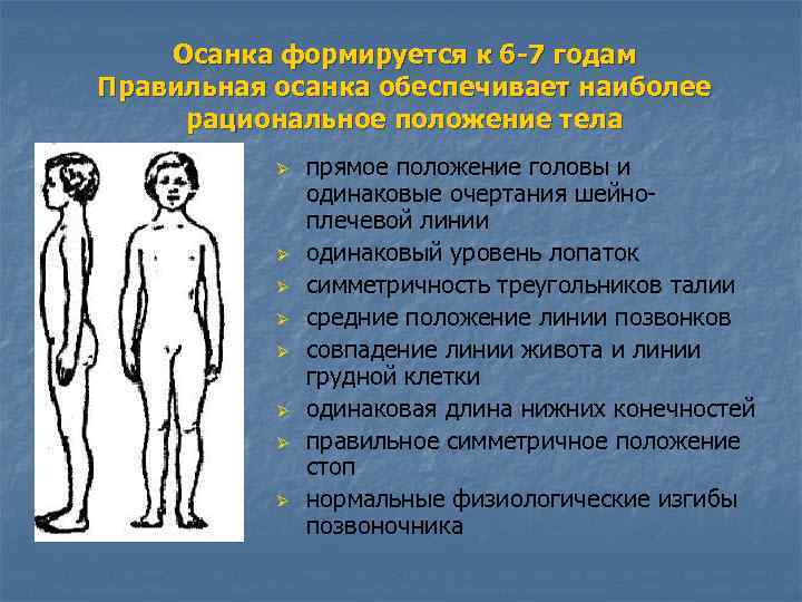 Осанка формируется к 6 -7 годам Правильная осанка обеспечивает наиболее рациональное положение тела Ø