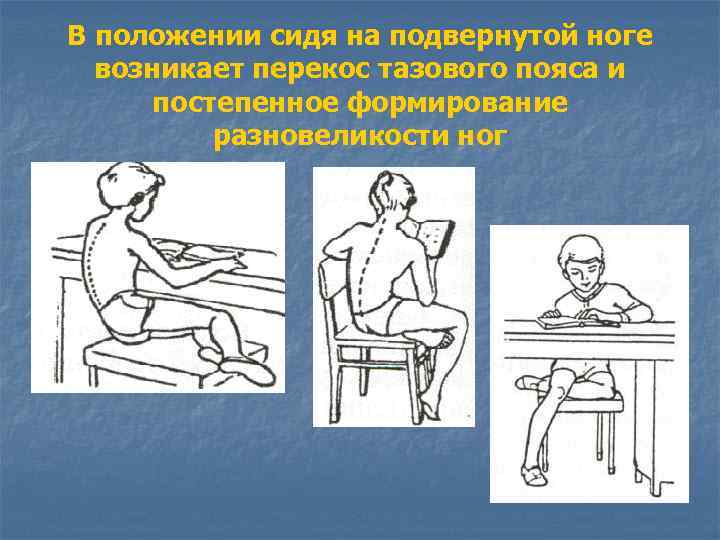 В положении сидя на подвернутой ноге возникает перекос тазового пояса и постепенное формирование разновеликости