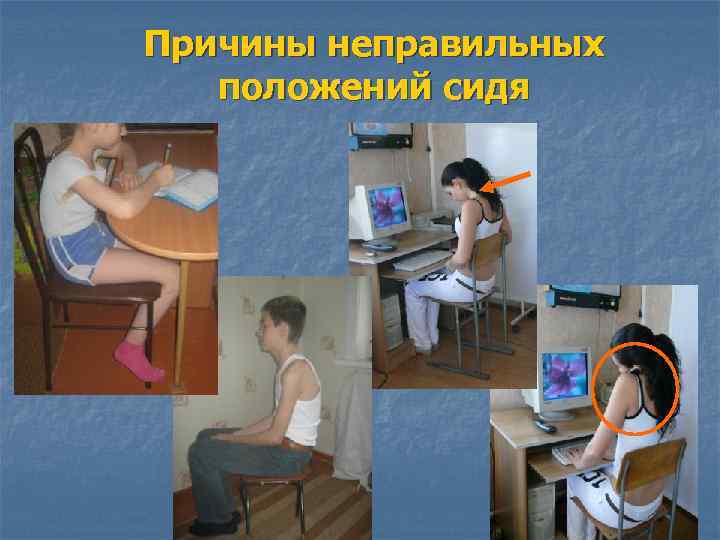 Причины неправильных положений сидя 