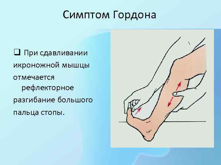 Симптом Гордона q При сдавливании икроножной мышцы отмечается рефлекторное разгибание большого пальца стопы. 