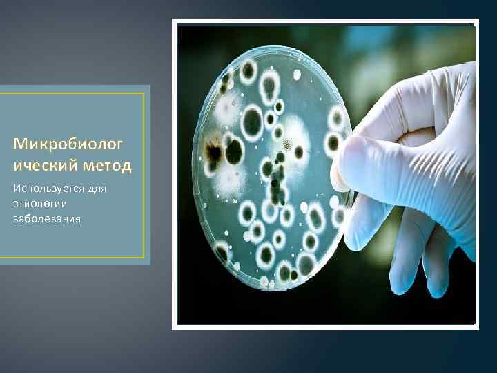 Микробиолог ический метод Используется для этиологии заболевания 