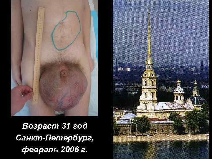 Возраст 31 год Санкт-Петербург, февраль 2006 г. 