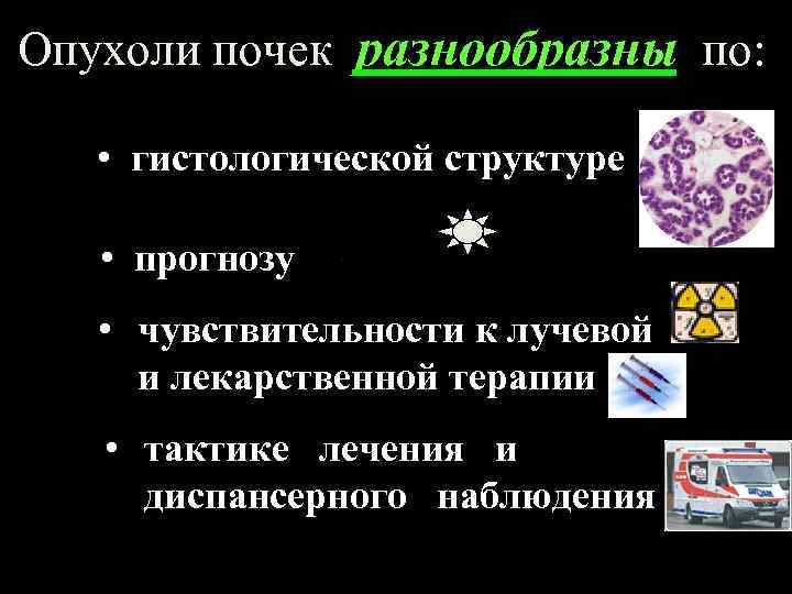 Опухоли почек разнообразны по: • гистологической структуре • прогнозу • чувствительности к лучевой и