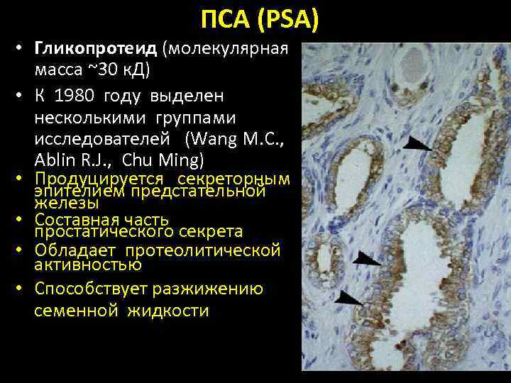 ПСА (PSA) • Гликопротеид (молекулярная масса ~30 к. Д) • К 1980 году выделен