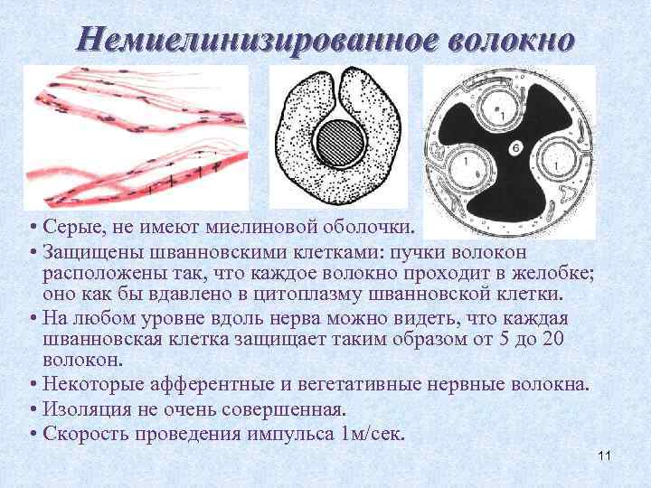 Немиелинизированное волокно • Серые, не имеют миелиновой оболочки. • Защищены шванновскими клетками: пучки волокон