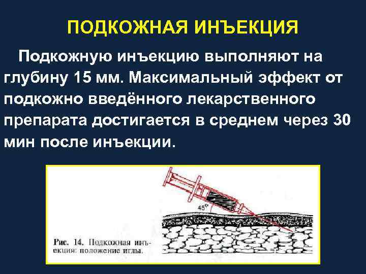 ПОДКОЖНАЯ ИНЪЕКЦИЯ Подкожную инъекцию выполняют на глубину 15 мм. Максимальный эффект от подкожно введённого