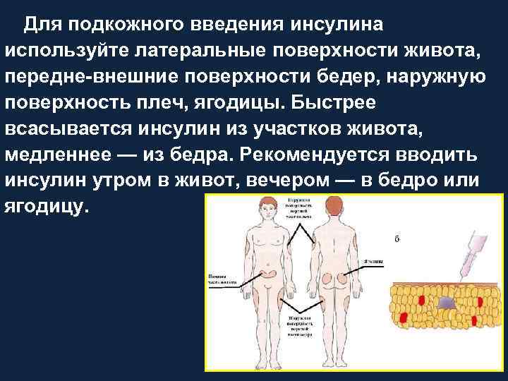 Подкожная инъекция кратко