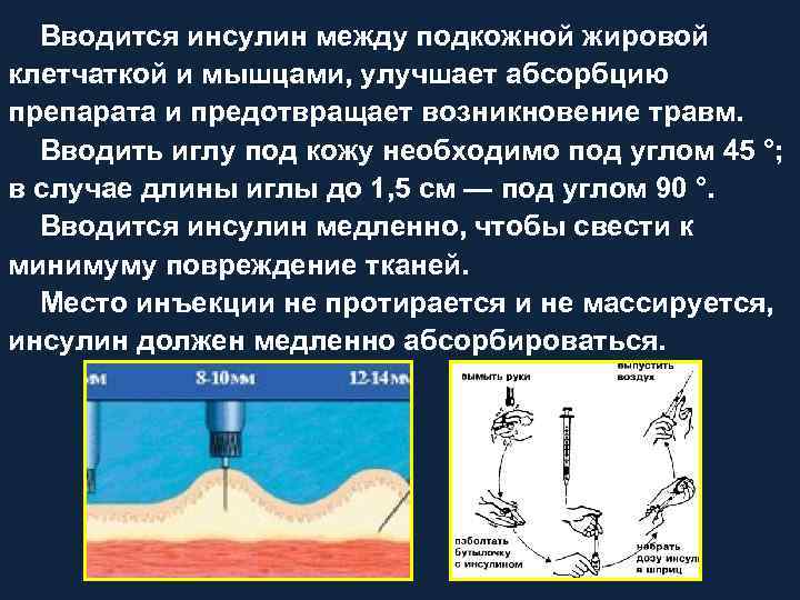 Вводится инсулин между подкожной жировой клетчаткой и мышцами, улучшает абсорбцию препарата и предотвращает возникновение