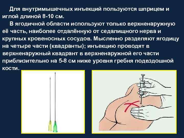 Как ставить укол в руку внутримышечно. Шприц для внутримышечных инъекций в ягодицу. Игла для внутримышечных инъекций.