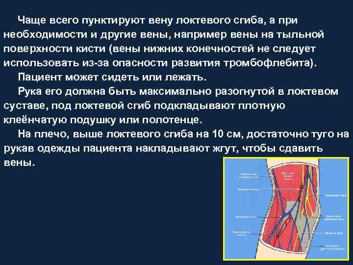 Чаще всего пунктируют вену локтевого сгиба, а при необходимости и другие вены, например вены