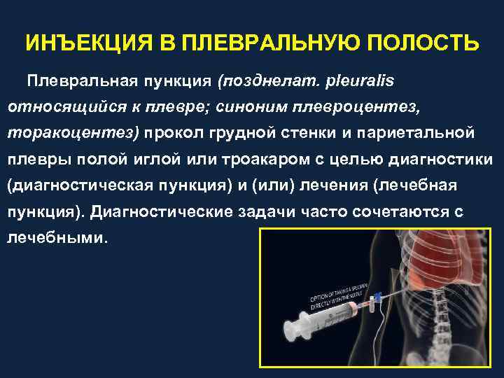 ИНЪЕКЦИЯ В ПЛЕВРАЛЬНУЮ ПОЛОСТЬ Плевральная пункция (позднелат. pleuralis относящийся к плевре; синоним плевроцентез, торакоцентез)